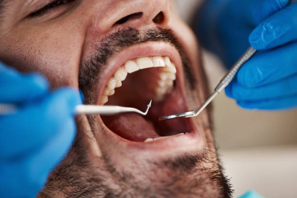 Best Pediatric Emergency Dentist in Ottumwa, IA
